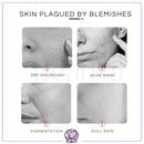 Vichy Liftactiv Supreme HA