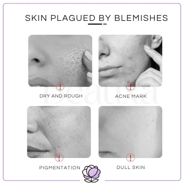 Vichy Liftactiv Supreme HA